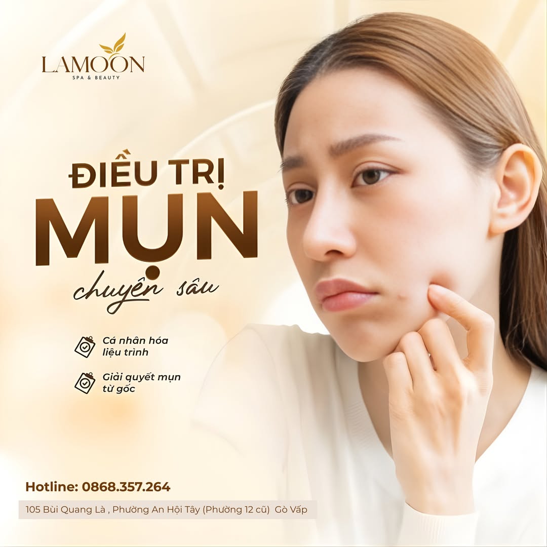 Điều Trị Mụn Chuyên Sâu Tại Lamoon Spa – Giải Pháp Cho Làn Da Khỏe Đẹp Từ Gốc