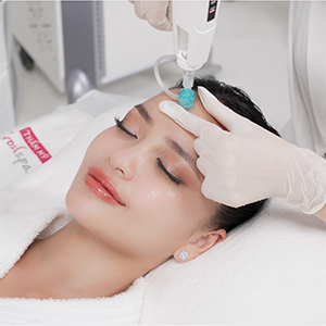 Detox Mụn CO2